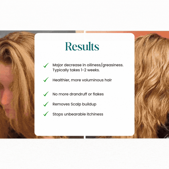 No Shampoo Hair Brush - White